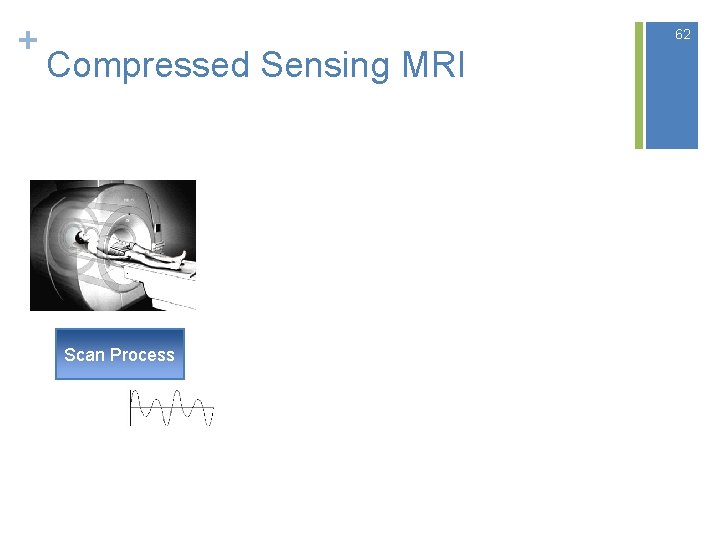 + 62 Compressed Sensing MRI Scan Process 