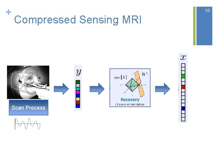 + 66 Compressed Sensing MRI Scan Process 