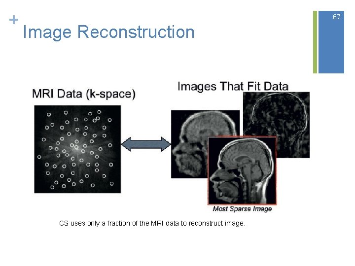 + 67 Image Reconstruction CS uses only a fraction of the MRI data to