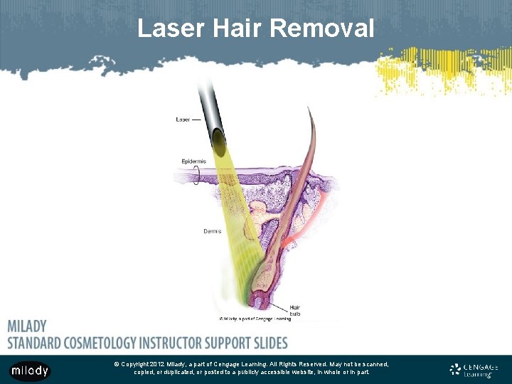 Laser Hair Removal © Copyright 2012 Milady, a part of Cengage Learning. All Rights