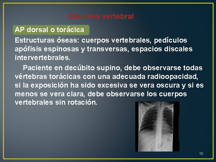 Columna vertebral AP dorsal o torácica Estructuras óseas: cuerpos vertebrales, pedículos apófisis espinosas y