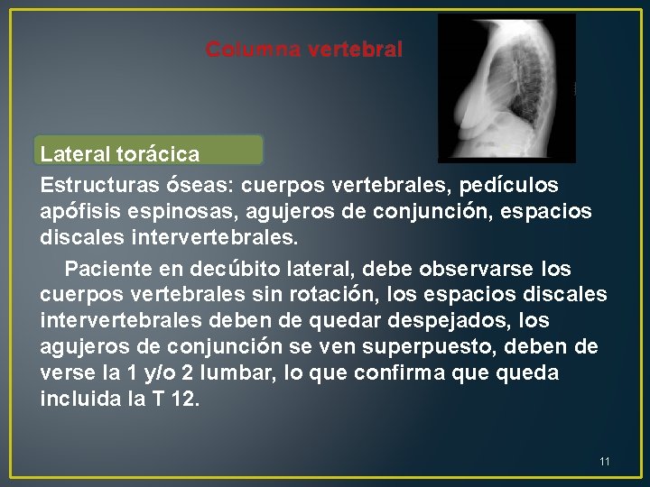 Columna vertebral Lateral torácica Estructuras óseas: cuerpos vertebrales, pedículos apófisis espinosas, agujeros de conjunción,