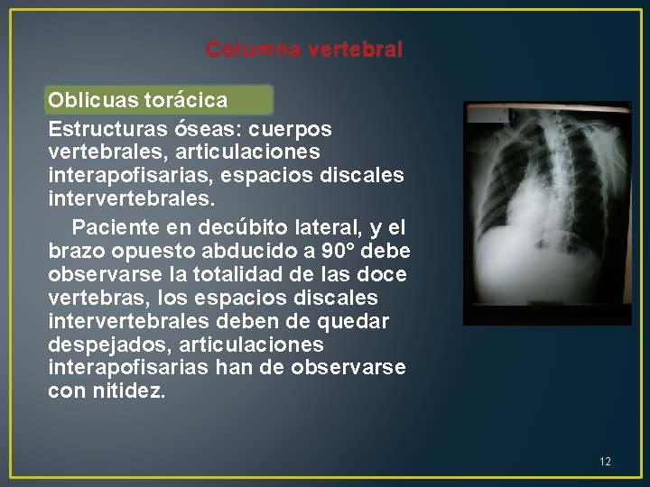 Columna vertebral Oblicuas torácica Estructuras óseas: cuerpos vertebrales, articulaciones interapofisarias, espacios discales intervertebrales. Paciente