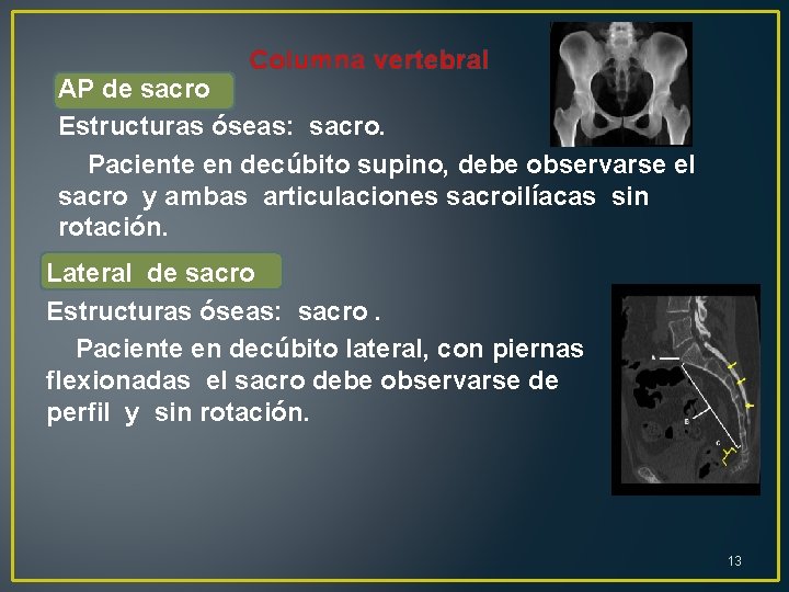 Columna vertebral AP de sacro Estructuras óseas: sacro. Paciente en decúbito supino, debe observarse