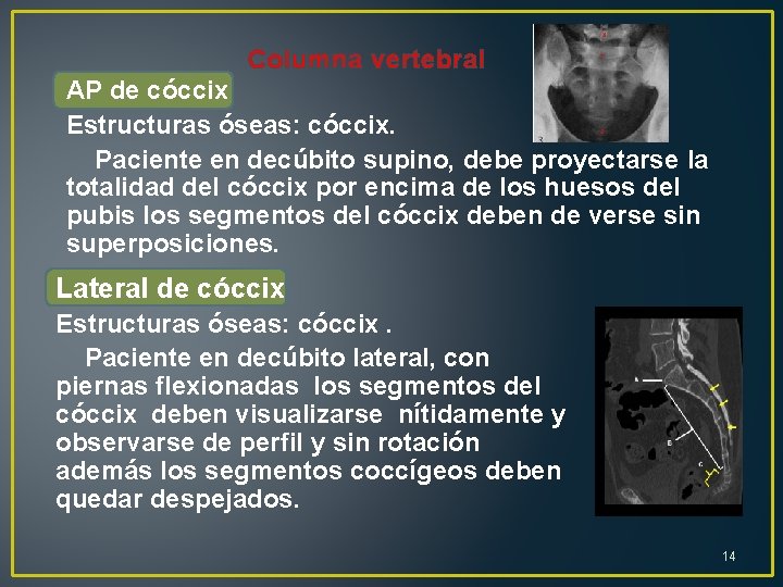 Columna vertebral AP de cóccix Estructuras óseas: cóccix. Paciente en decúbito supino, debe proyectarse