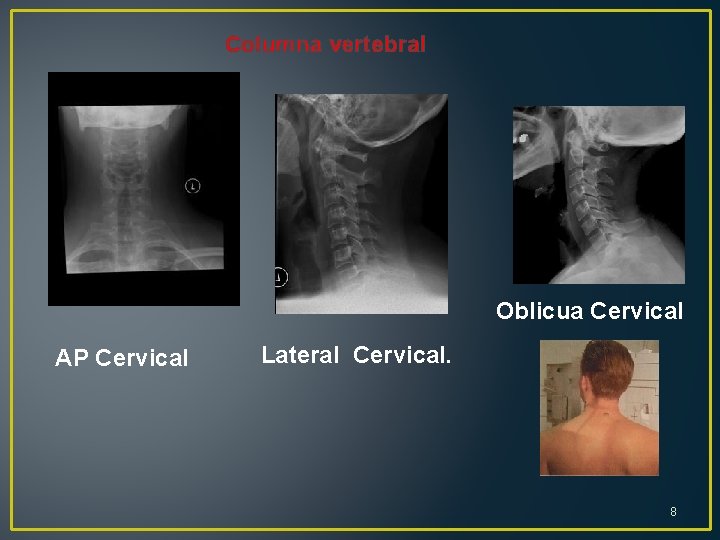 Columna vertebral Oblicua Cervical AP Cervical Lateral Cervical. 8 