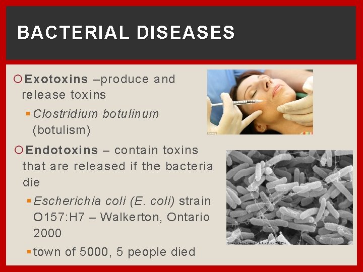 BACTERIAL DISEASES Exotoxins –produce and release toxins § Clostridium botulinum (botulism) Endotoxins – contain