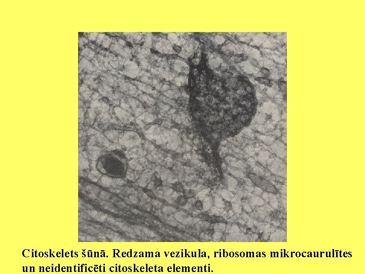 Citoskelets šūnā. Redzama vezikula, ribosomas mikrocaurulītes un neidentificēti citoskeleta elementi. 