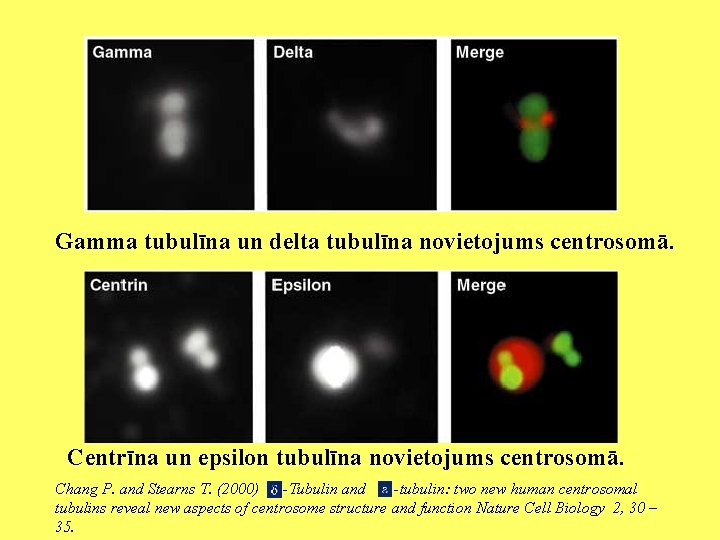 Gamma tubulīna un delta tubulīna novietojums centrosomā. Centrīna un epsilon tubulīna novietojums centrosomā. Chang