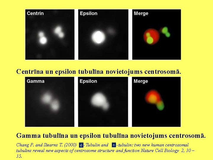 Centrīna un epsilon tubulīna novietojums centrosomā. Gamma tubulīna un epsilon tubulīna novietojums centrosomā. Chang
