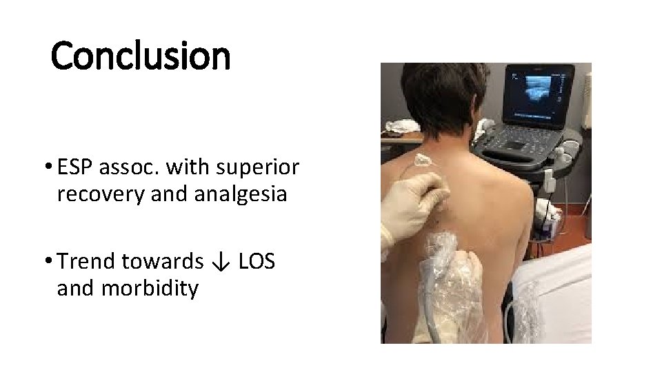 Conclusion • ESP assoc. with superior recovery and analgesia • Trend towards ↓ LOS