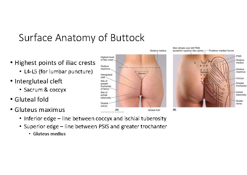 Surface Anatomy of Buttock • Highest points of iliac crests • L 4‐L 5