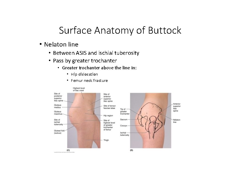 Surface Anatomy of Buttock • Nelaton line • Between ASIS and ischial tuberosity •