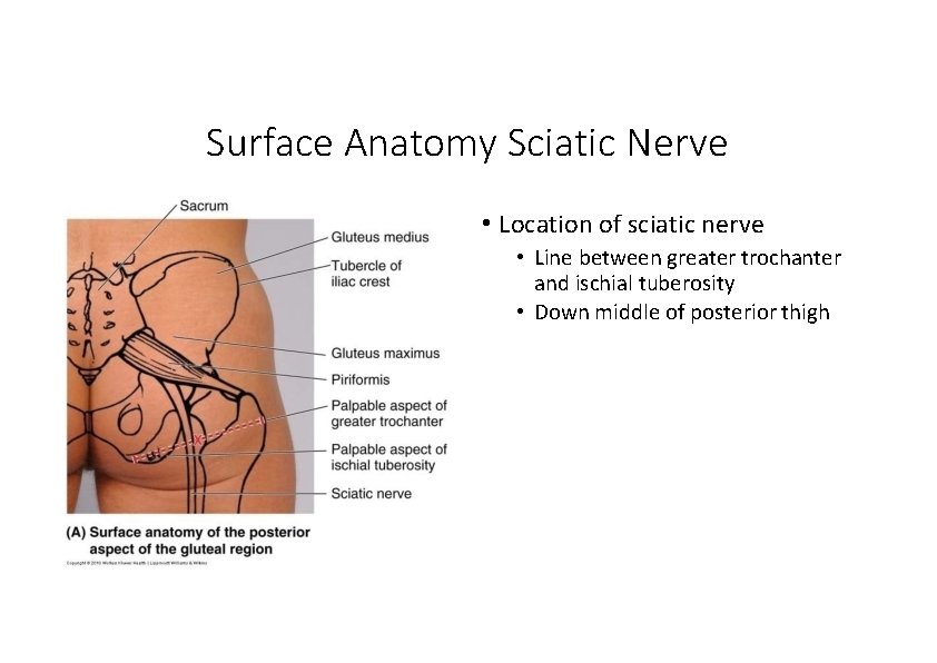 Surface Anatomy Sciatic Nerve • Location of sciatic nerve • Line between greater trochanter