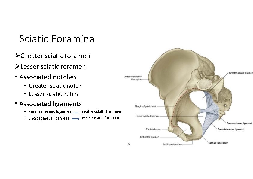 Sciatic Foramina Greater sciatic foramen Lesser sciatic foramen • Associated notches • Greater sciatic