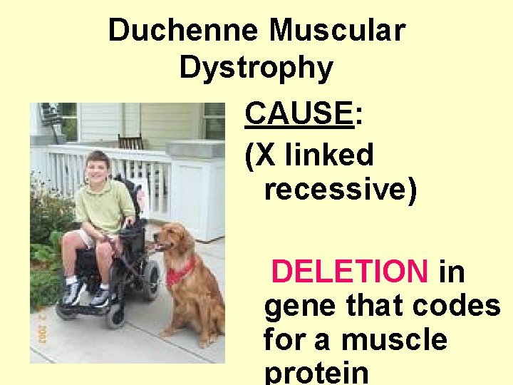 Duchenne Muscular Dystrophy CAUSE: (X linked recessive) DELETION in gene that codes for a