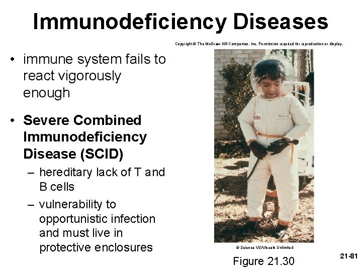 Immunodeficiency Diseases Copyright © The Mc. Graw-Hill Companies, Inc. Permission required for reproduction or