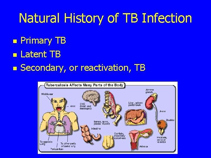 Natural History of TB Infection n Primary TB Latent TB Secondary, or reactivation, TB