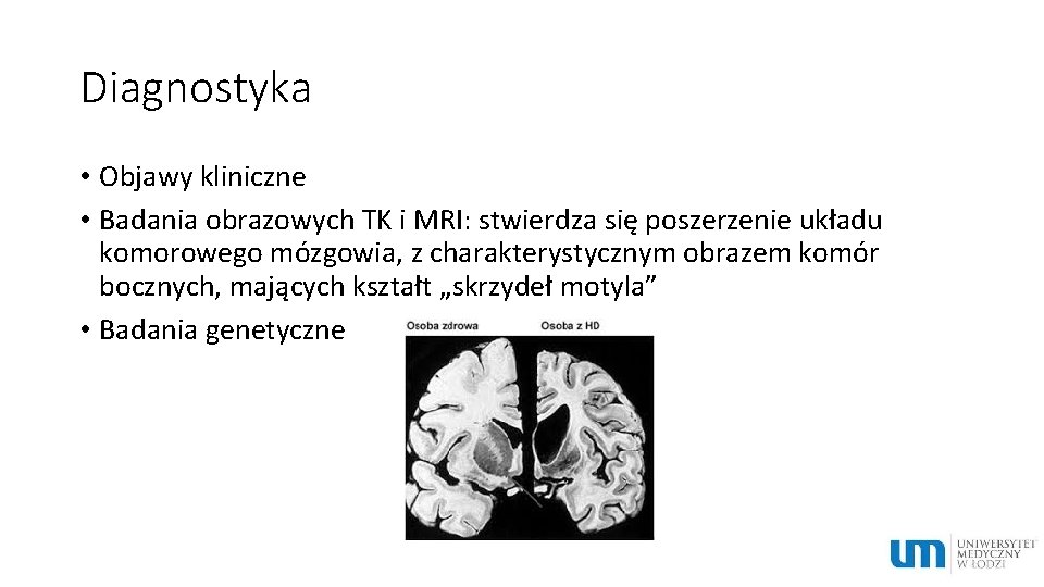 Diagnostyka • Objawy kliniczne • Badania obrazowych TK i MRI: stwierdza się poszerzenie układu