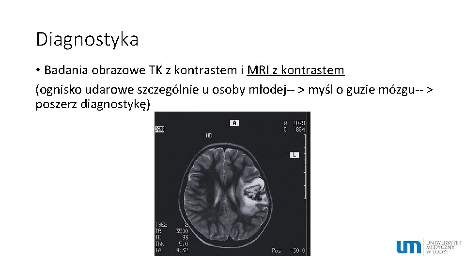 Diagnostyka • Badania obrazowe TK z kontrastem i MRI z kontrastem (ognisko udarowe szczególnie