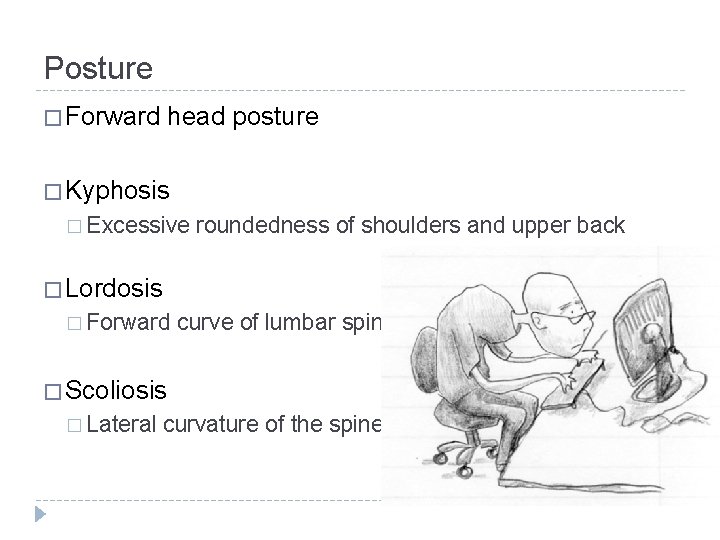 Posture � Forward head posture � Kyphosis � Excessive roundedness of shoulders and upper