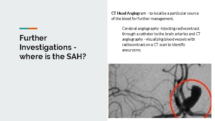CT Head Angiogram - to localise a particular source of the bleed for further