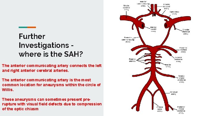 Further Investigations where is the SAH? The anterior communicating artery connects the left and