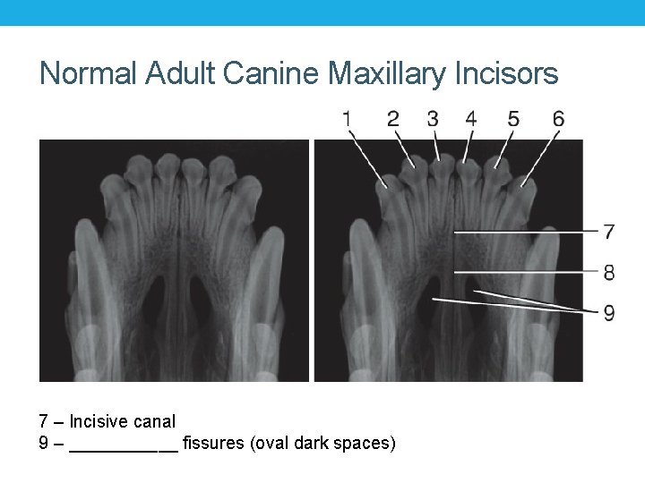 Normal Adult Canine Maxillary Incisors 7 – Incisive canal 9 – ______ fissures (oval