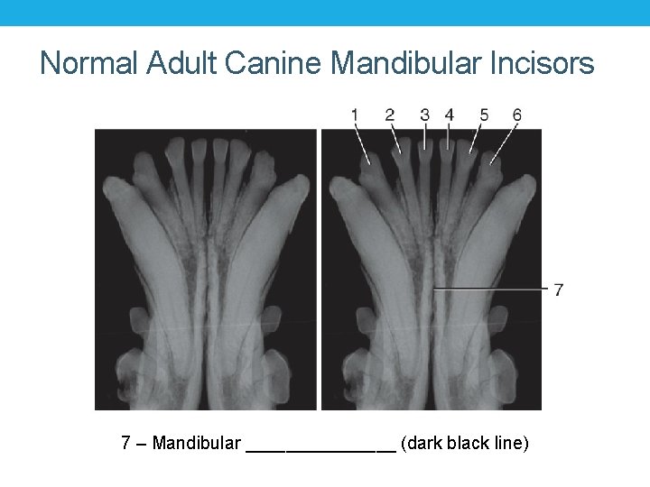 Normal Adult Canine Mandibular Incisors 7 – Mandibular ________ (dark black line) Normal Adult Canine Mandibular Incisors 7 – Mandibular ________ (dark black line)
