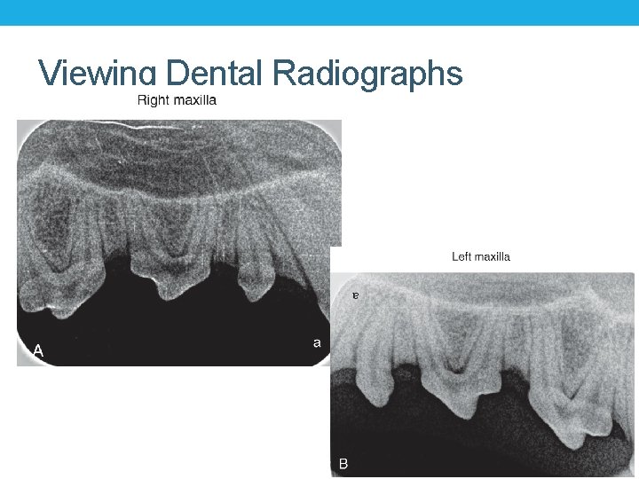Viewing Dental Radiographs 