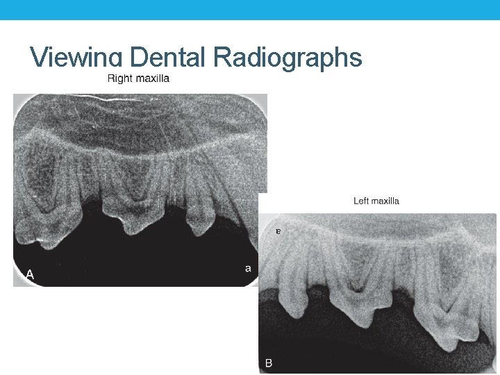Viewing Dental Radiographs Viewing Dental Radiographs