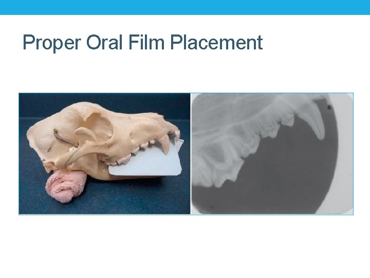 Proper Oral Film Placement Proper Oral Film Placement