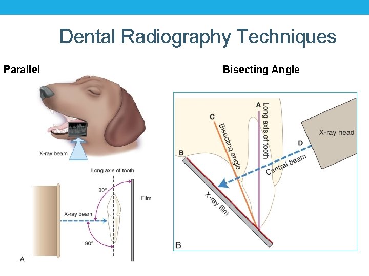 Dental Radiography Techniques Parallel Bisecting Angle 