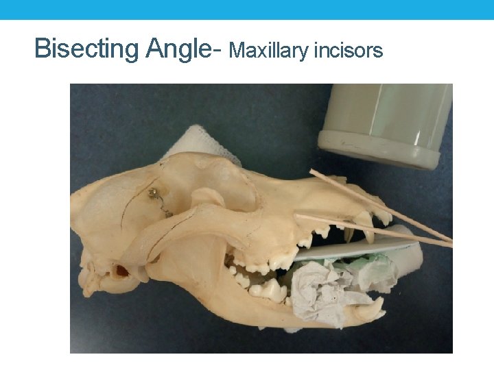 Bisecting Angle- Maxillary incisors 