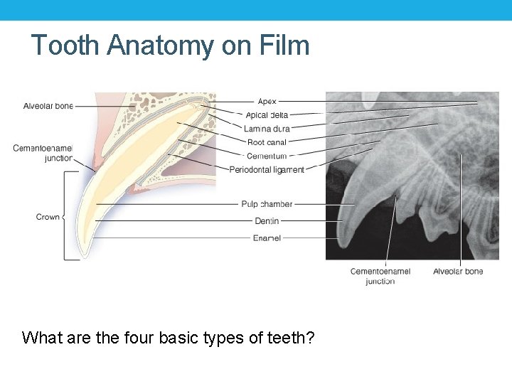 Tooth Anatomy on Film What are the four basic types of teeth? 