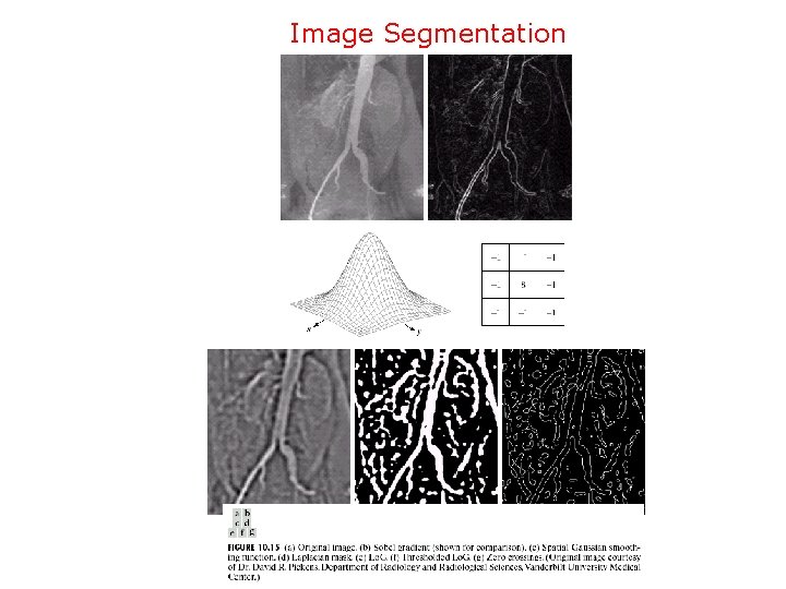 Image Segmentation 
