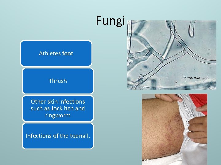 Fungi Athletes foot Thrush Other skin infections such as Jock itch and ringworm Infections