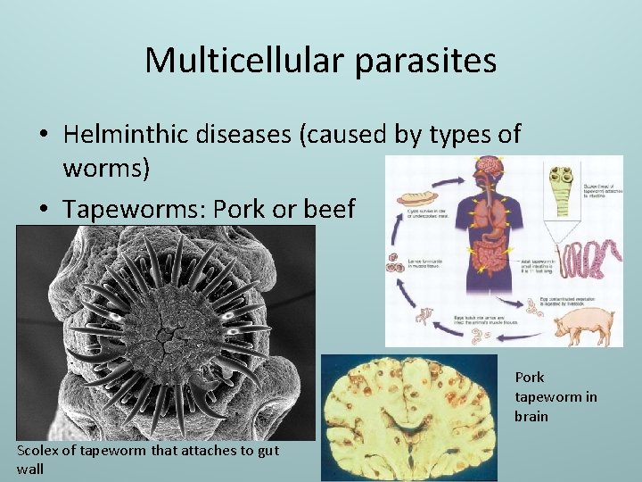 Multicellular parasites • Helminthic diseases (caused by types of worms) • Tapeworms: Pork or