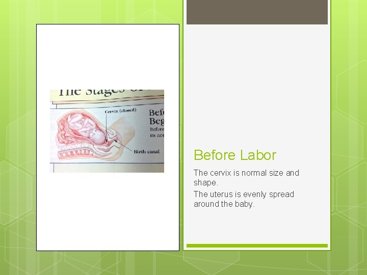 Before Labor The cervix is normal size and shape. The uterus is evenly spread