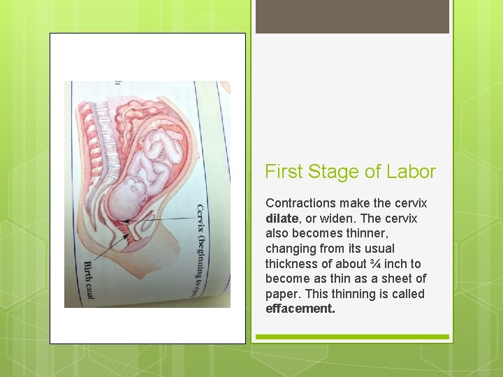 First Stage of Labor Contractions make the cervix dilate, or widen. The cervix also