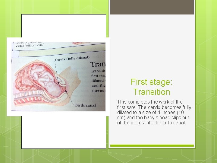 First stage: Transition This completes the work of the first sate. The cervix becomes