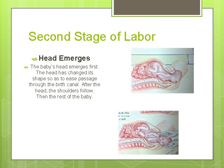 Second Stage of Labor Head Emerges The baby’s head emerges first. The head has