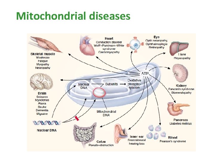 Mitochondrial diseases Mitochondrial diseases