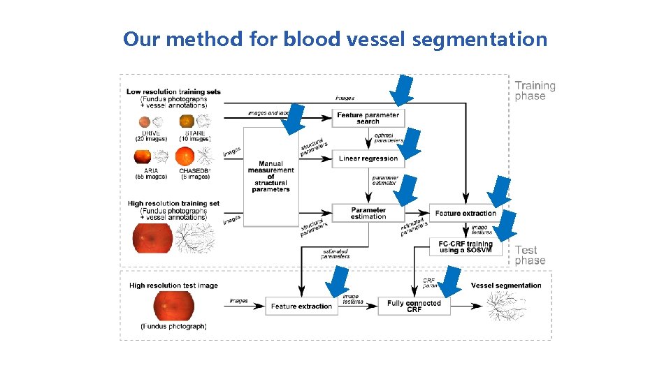 Our method for blood vessel segmentation 
