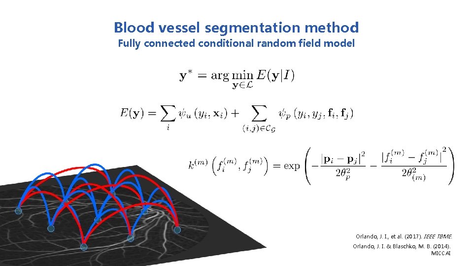 Blood vessel segmentation method Fully connected conditional random field model Orlando, J. I. ,