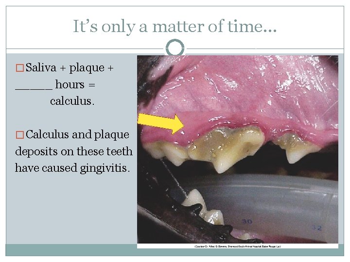 It’s only a matter of time… � Saliva + plaque + _____ hours =
