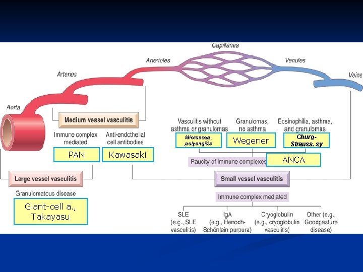 Microscop. polyangiits PAN Giant-cell a. , Takayasu Kawasaki Wegener Churg. Strauss. sy ANCA 