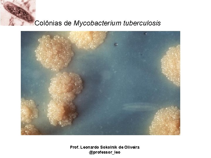 Colônias de Mycobacterium tuberculosis Prof. Leonardo Sokolnik de Oliveira @professor_leo 