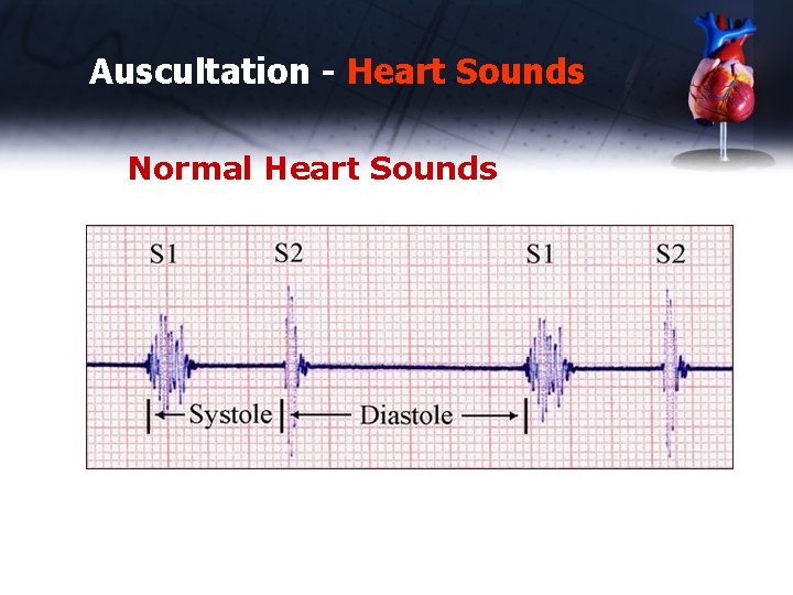 Auscultation - Heart Sounds Normal Heart Sounds 