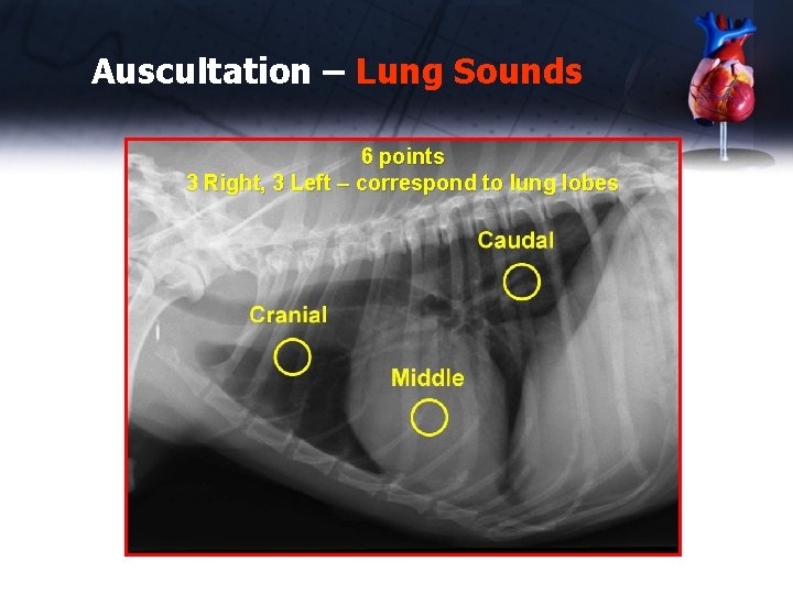 Auscultation – Lung Sounds 6 points 3 Right, 3 Left – correspond to lung